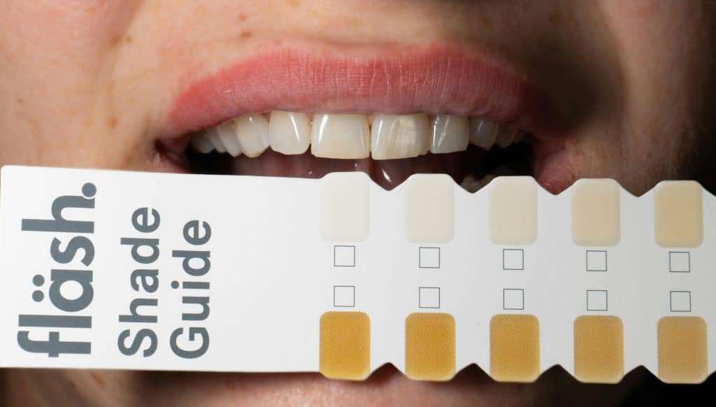 Dentist holding a dental shade guide to compare tooth whitening results.