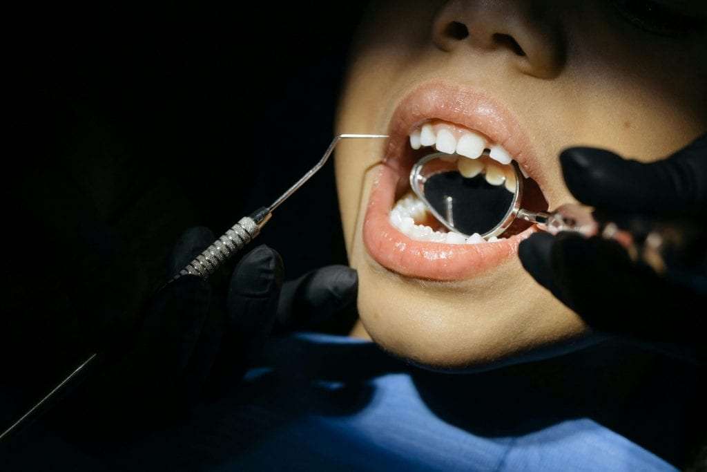 A close-up view of a child undergoing a dental examination with tools in their mouth.