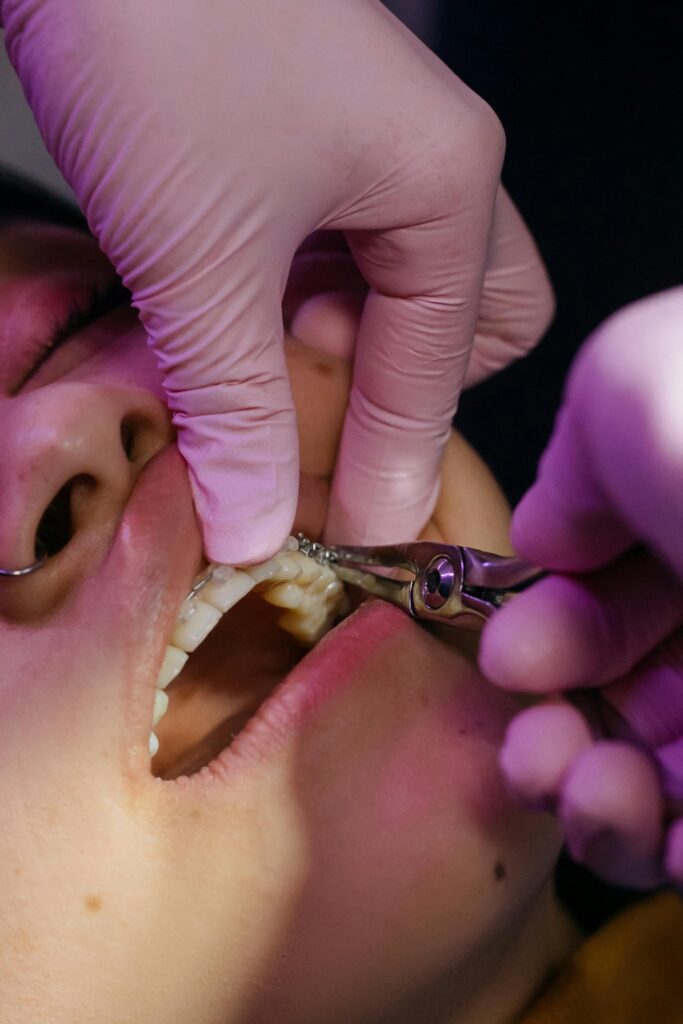 braces A detailed close-up of a dental procedure of braces tightening