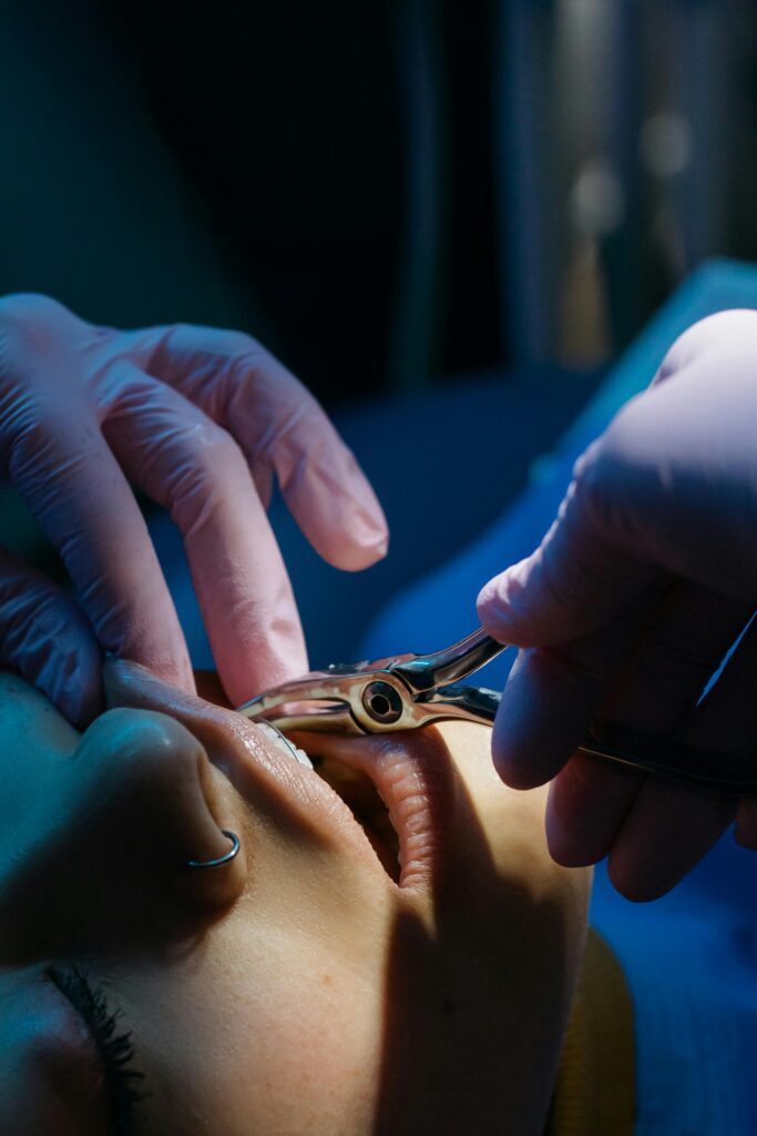 pexels-photo-6528868-6528868 Detailed close-up of a dental procedure with a patient receiving treatment by a dentist.